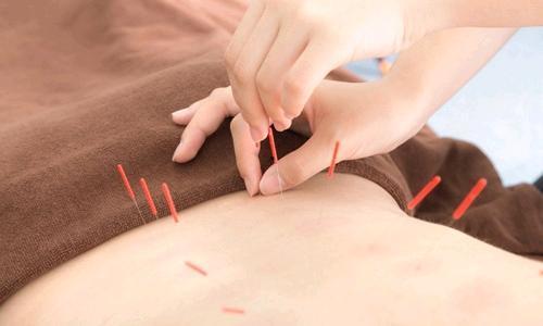 针灸视频教学,入门到精通的实用指南