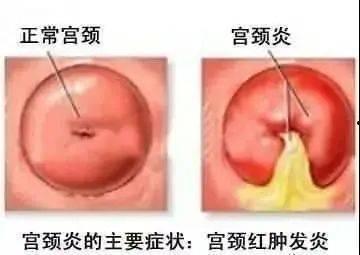 宫颈视频,视频揭秘宫颈检查全过程
