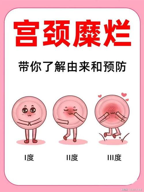 宫颈视频,视频揭秘宫颈检查全过程